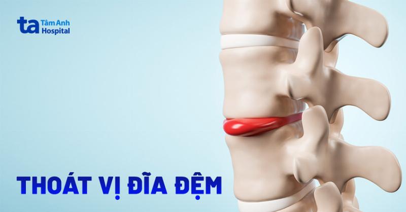 Bệnh Án Gãy Xương Cẳng Chân: Cẩm Nang Chi Tiết Từ A-Z Cho Sinh Viên Y Khoa